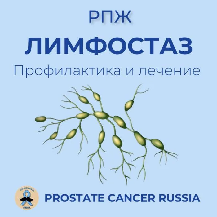 Lymphostasis prevention and treatment - Cancer and oncology, Prostate cancer, Longpost