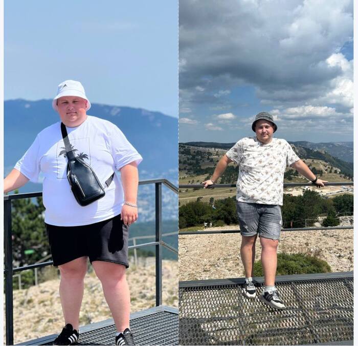 Bariatrics. Results of 7 months - My, Bariatrics, Slimming, Operation, Excess weight, Outcomes, New life, Longpost