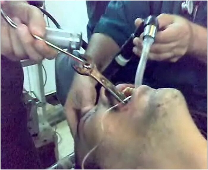 Figure 2.  Magill     .