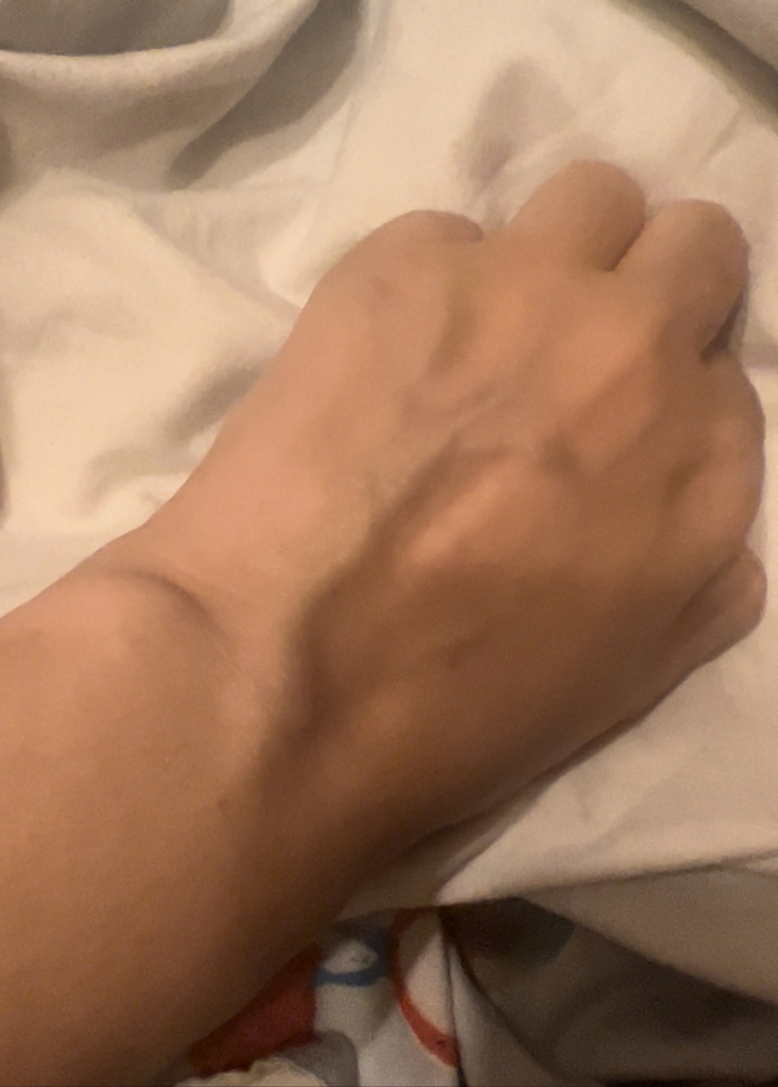 опущена рука, в реале вена даже больше, чем на фото видно, прямо очень толстая и широкая