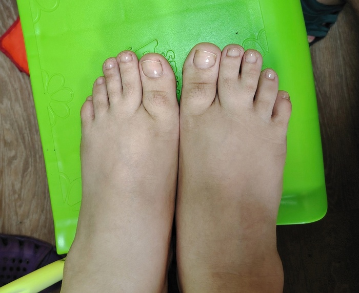 Я уже не вспомню, когда была сделана фотография. Скорее всего либо после нанесения праймера, либо после нанесения базы.