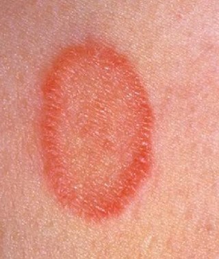 From the practice of a pediatrician: what kind of rash is this? - My, The medicine, Health, Rash, Doctors, Pediatrician, Longpost, Dermatology, Rare diseases