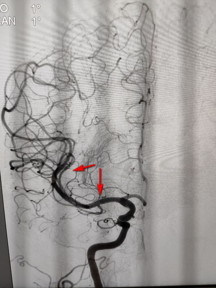 После вмешательства.
