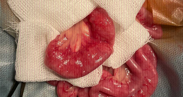 Почему-то операционная лампа плохо влияет на камеру телефона и даёт такие полосы