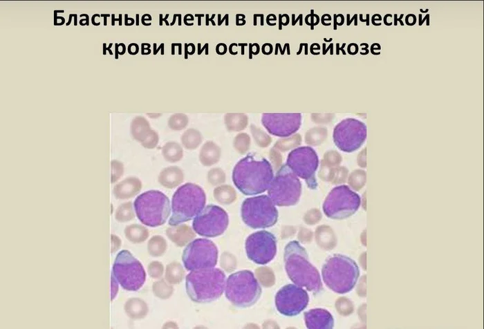 «Силы уходят!» Случай из практики - Врачи, Скорая помощь, Негатив, История болезни, Яндекс Дзен, Яндекс Дзен (ссылка), Длиннопост