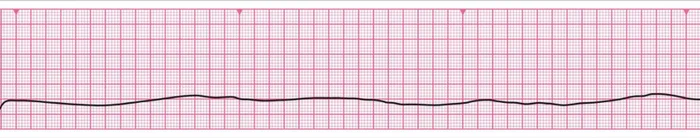 An unusual case in intensive care - Doctors, Ambulance, Disease history, Yandex Zen, Yandex Zen (link)