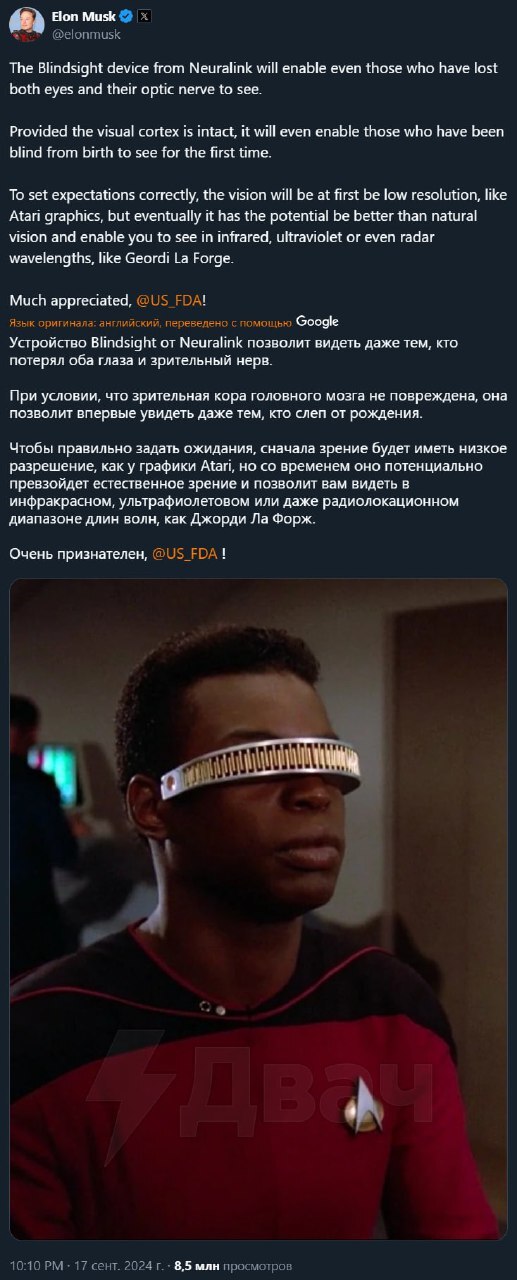 Neuralink Releases Device That Restores Vision Even to Those Blind Since Birth - Elon Musk, Vision, Neuralink