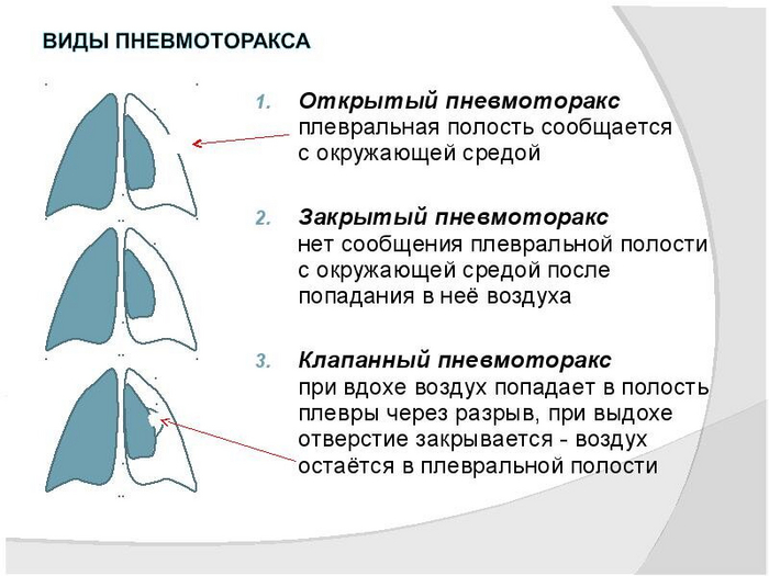     ,  , ,  ,  ,   ()