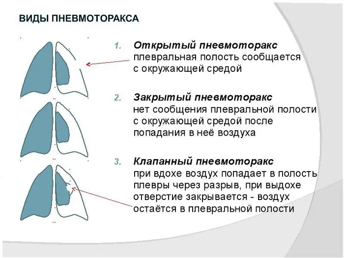 Огнестрельное ранение грудной клетки - Врачи, Скорая помощь, Негатив, История болезни, Яндекс Дзен, Яндекс Дзен (ссылка)