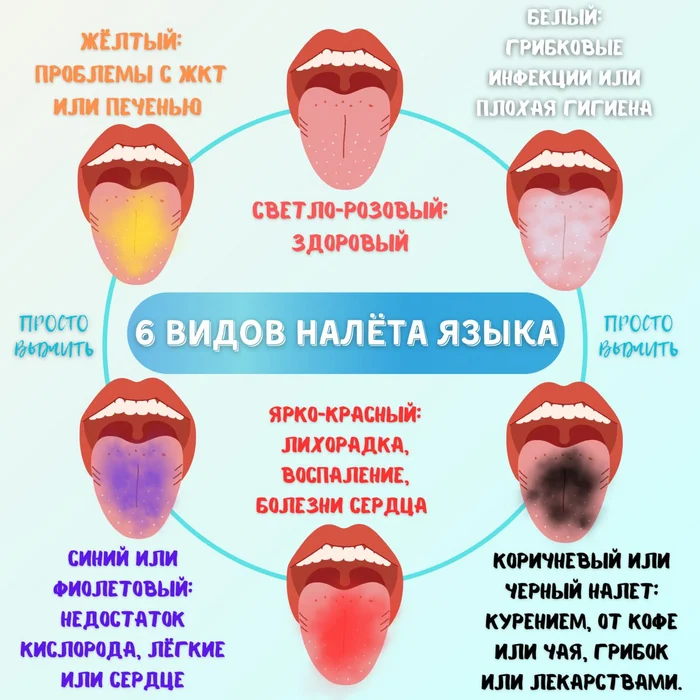 6 оттенков языка: что он расскажет о вашем здоровье - Моё, Здоровье, Обучение, Инфографика, Язык, Цвет, Болезнь, Вид, Налет, Оттенок, Медицина, Стоматология, Терапевт, Симптомы, Зубы, Рот, Патологическая анатомия, Проблема, Важно, Жкт, Воспаление