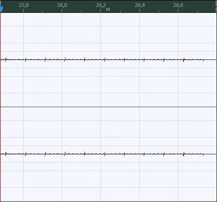 Tyk tyk tyk when recording from a microphone - Question, Ask Peekaboo, Need advice, No rating, Problem, Sound recording