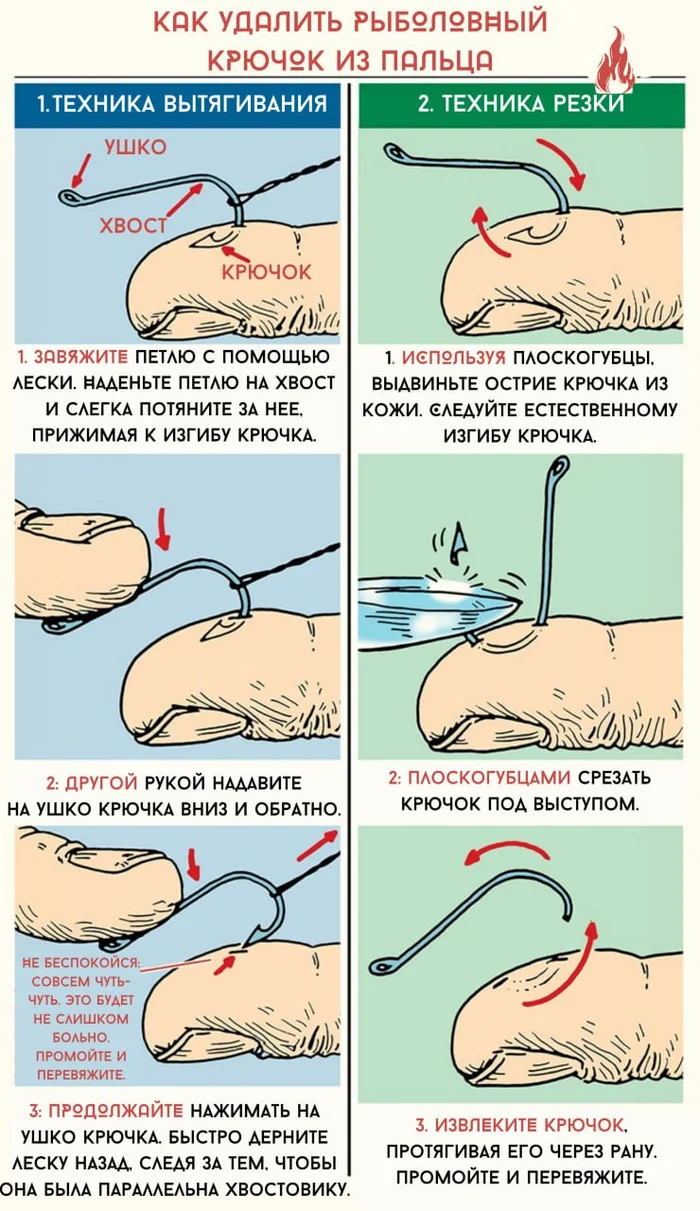 How to Safely Remove a Fishing Hook from Your Finger: Two Visual Methods - Survival, Education, Health, Forest, Nature, Hike, Travels, Hook, Fishing, Rules, Cutting, Extract, Infographics, Fingers, Wound, Удаление, How?, Technics