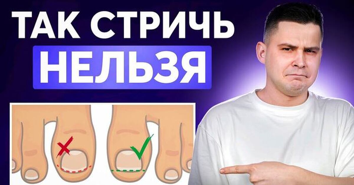 А вы знали как правильно стричь ногти? | Пикабу