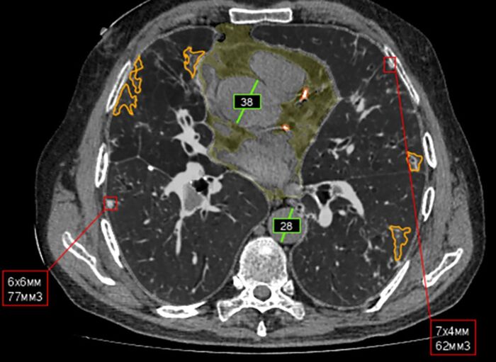 Как создаются российские медицинские ИИ-сервисы