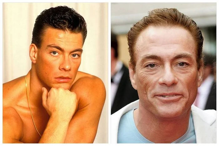 Where did Van Damme get the bump on his forehead? Versions, opinions, revelations - Jean-Claude Van Damme, Forehead, The secret is revealed, Actors and actresses, Hollywood, Longpost