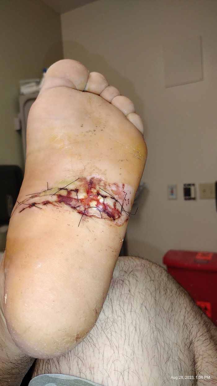 MRSA -   , , ,  ,  , 