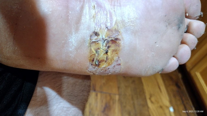 ���������� ��������