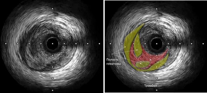    ( )     ,      (100% ) +    .