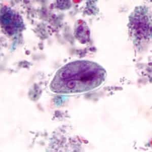 Giardiasis - My, Treatment, The medicine, Doctors, Giardia, Protozoa, Parasites, Longpost