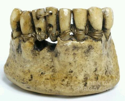 Dentures in the Ancient World - Antiquity, Ancient Rome, History (science), Prosthetics