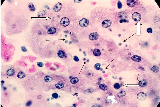 Toxoplasma: The Most Successful Manipulator - My, Research, Nauchpop, The science, Scientists, Toxoplasmosis, Toxoplasma, cat, Biology, Parasites, Dopamine, Video, Youtube, Longpost