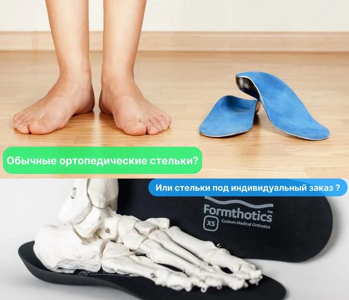 I recently started experiencing pain in my feet and thought about buying orthopedic insoles. - Survey, Health, Orthopedics, Flat feet