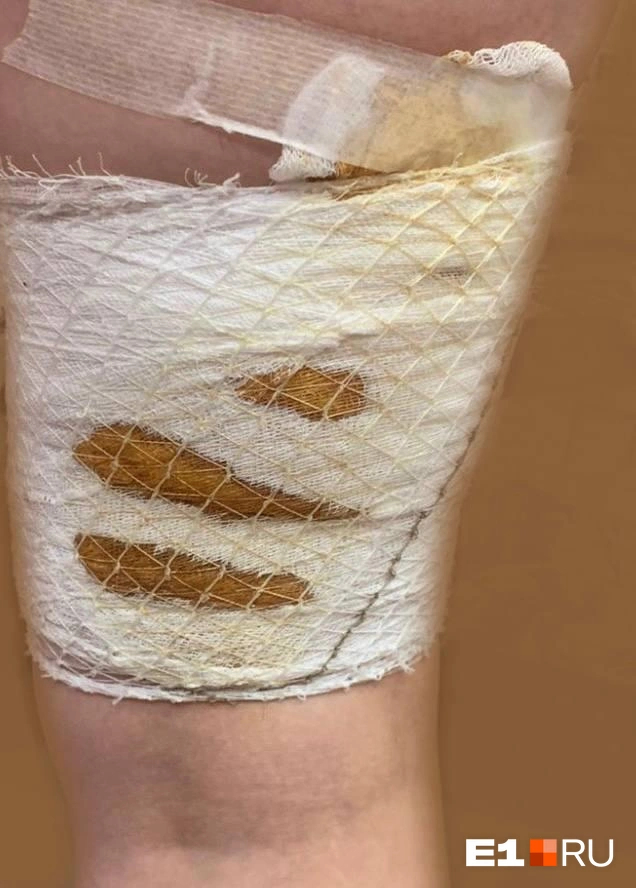 Злобные собаки покусали жительницу ВторчерметаИсточник: читательница <!--noindex--><a href="https://pikabu.ru/story/shla_domoy__i_okazalas_v_travmpunkte_na_vtorchermete_zlobnyie_sobaki_iskusali_devushku_11923771?u=http%3A%2F%2FE1.RU&t=E1.RU&h=d14cb2f4849bc246a517d6332b909846dc263a36" title="http://E1.RU" target="_blank" rel="nofollow noopener">E1.RU</a><!--/noindex-->