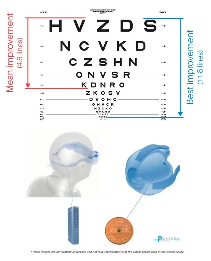 Scientists have conquered blindness for the first time in history - Research, Brain, The science, Telegram (link)