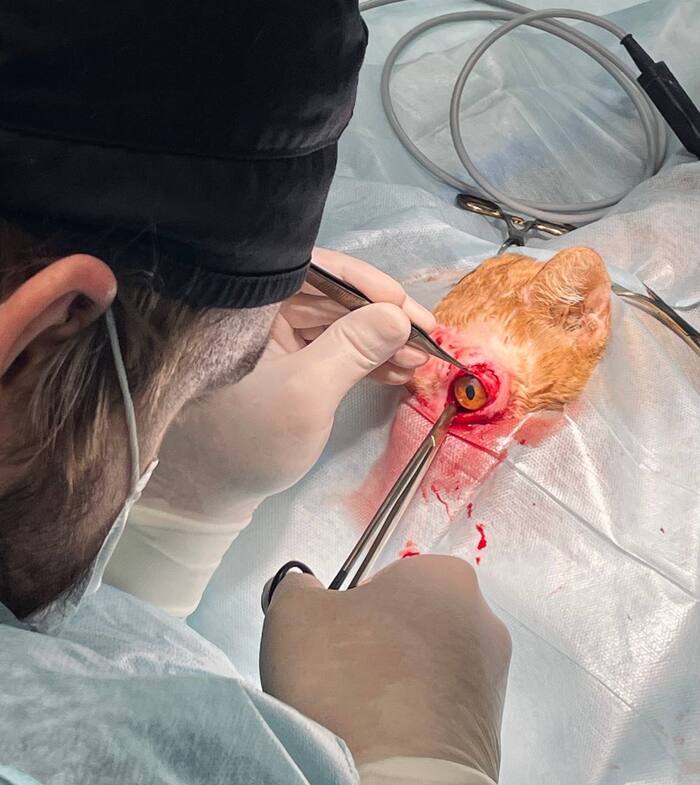 Сначала - энуклеация с промыванием полости и всех свищей.