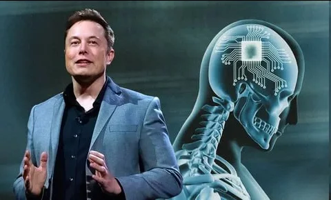 Neuralink Receives FDA Clearance to Implant New Chip into Patient's Brain - My, Research, Technologies, Innovations, Elon Musk, Neuralink, Chip