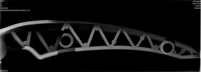 Снимаем люминевое перо и тащим в рентген. Можно и по фото, но так геометрических искажений меньше и вообще....