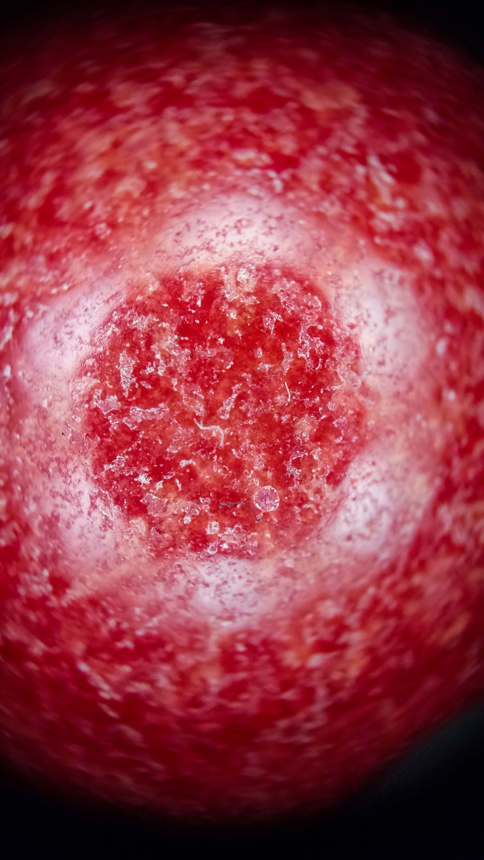 И снова эти волоски