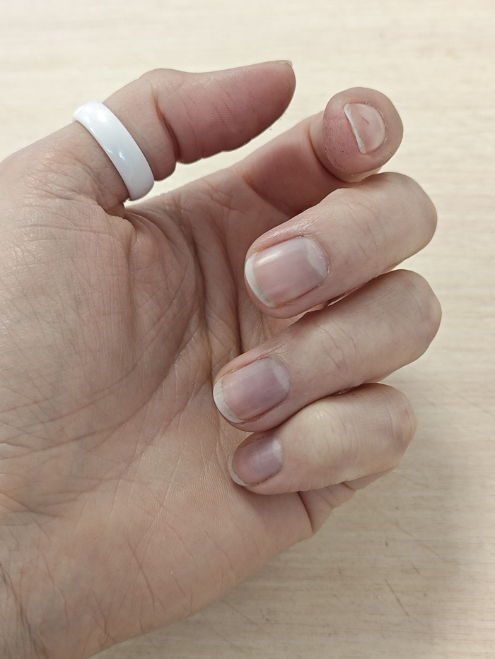 ���������� �� ����-�������� �������