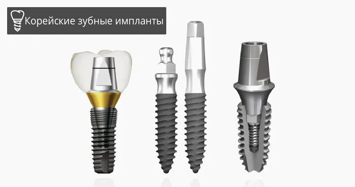 Korean Dental Implants Comparison - Dentistry, Health, Telegram (link), Longpost