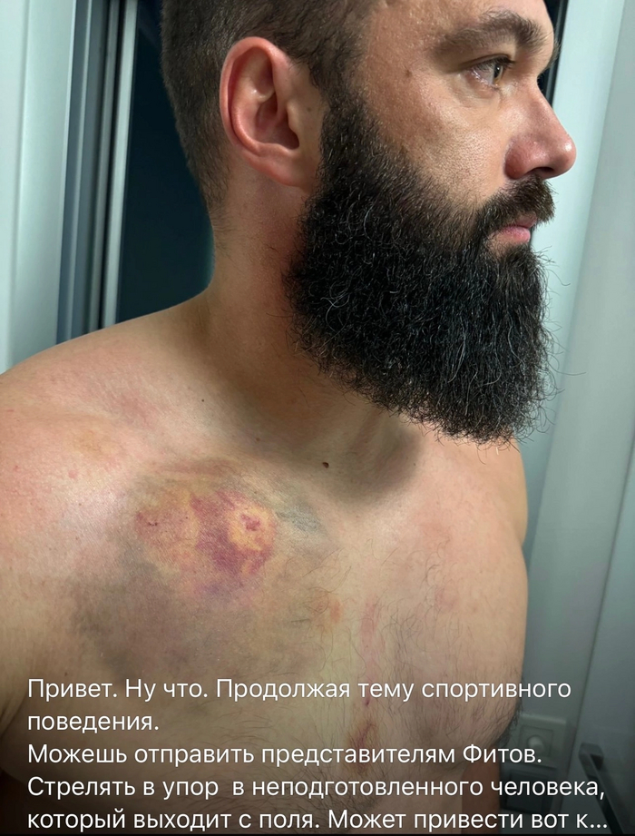      NXL 2024 ,  , , NXL (  ), ,  , Rl (Russian Legion), 