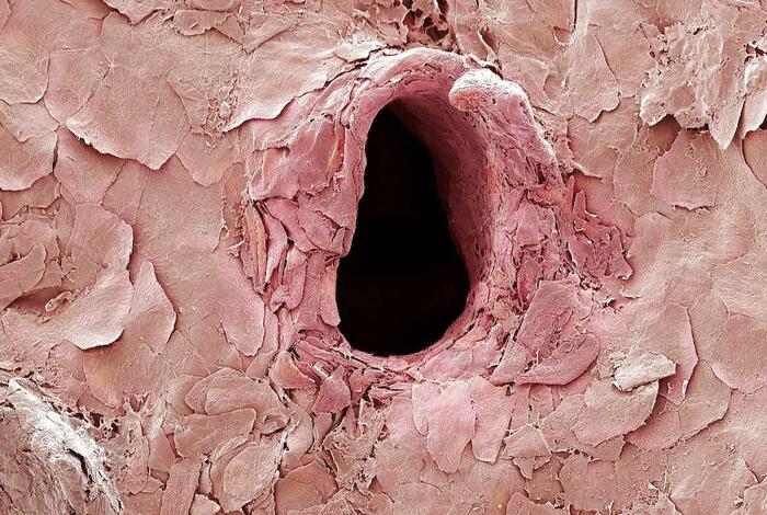 This is what a hole in the skin looks like after being punctured with a needle under an electron microscope - Leather, Needle, An injection, Increase, Microscope