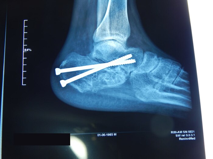 Вторая операция.