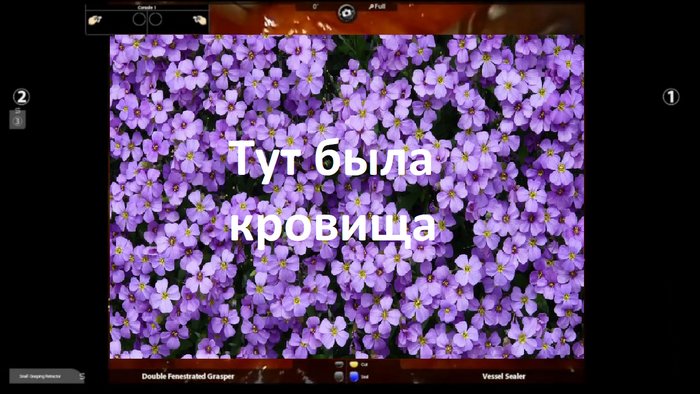 Хотел сначала кровь и кишки, а потом вспомнил, что большинство у нас не хирурги, а трусишки :-)
