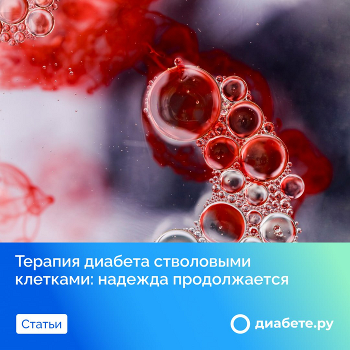 Терапия диабета стволовыми клетками: надежда продолжается