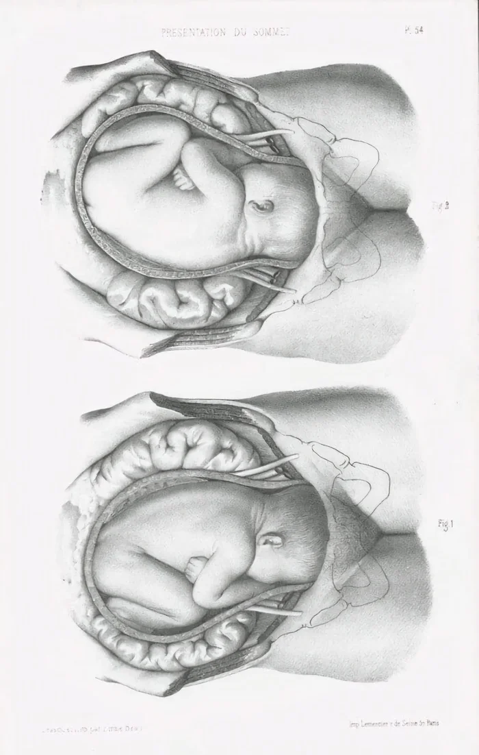 Sweet captivity of the womb - Fruit, Adulthood, Pregnancy, Anatomy, Children