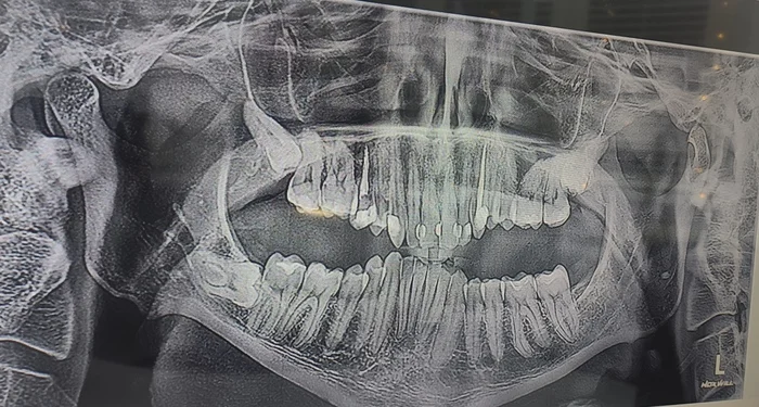 Need a consultation - My, Bad teeth, Dentistry, Consultation