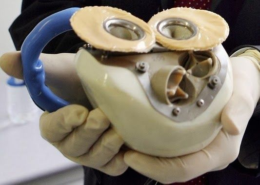 Artificial heart transplant - My, The science, Scientists, Research, Heart, Artificial, Artificial heart, Technologies, Heart transplant, Transfer, Operation, Inventions, A life, Longpost