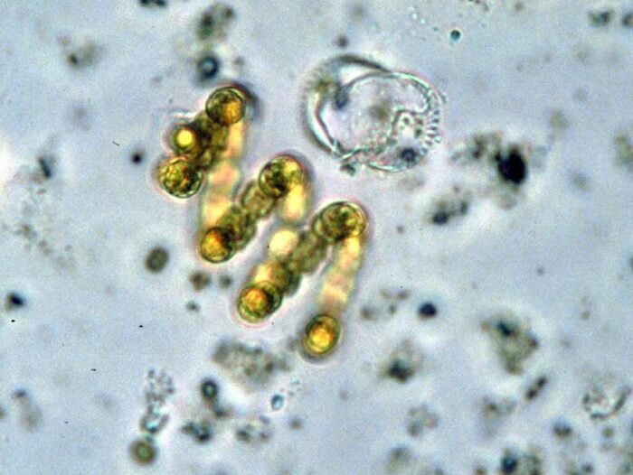  (. Anabaena)     /  <!--noindex--><a href="https://pikabu.ru/story/kislorodnaya_revolyutsiya_kak_bakterii_izmenili_litso_zemli_12080779?u=http%3A%2F%2Fepa.gov&t=epa.gov&h=0bf2c002605c180f791f3c1ce20d45e3a3058f5c" title="http://epa.gov" target="_blank" rel="nofollow noopener">epa.gov</a><!--/noindex-->