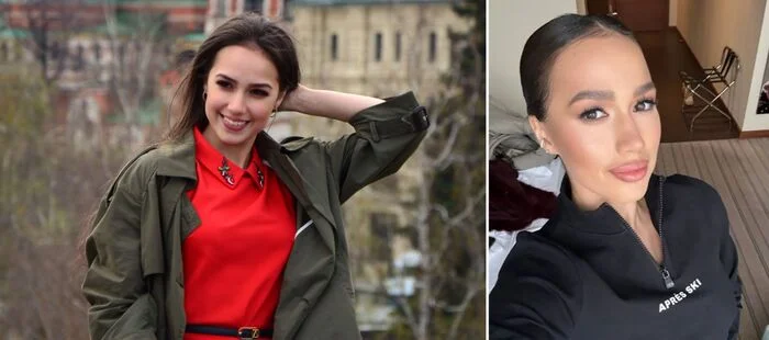 Alina Zagitova 2019 vs 2024 - Russia, Girls, Figure skating, It Was-It Was, Facial plastic surgery, Silicone, Lips, Plump lips, The photo, Alina Zagitova, Society, Telegram (link)