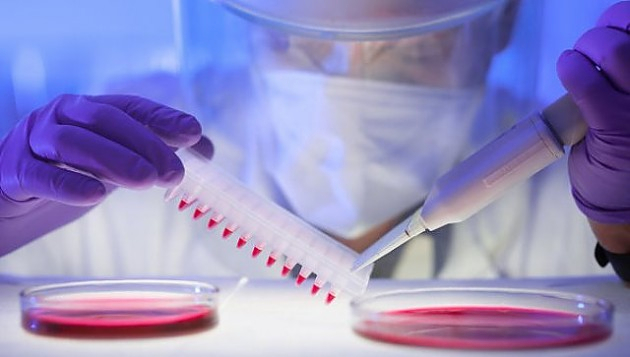 Анализ крови позволит предсказать болезнь Альцгеймера