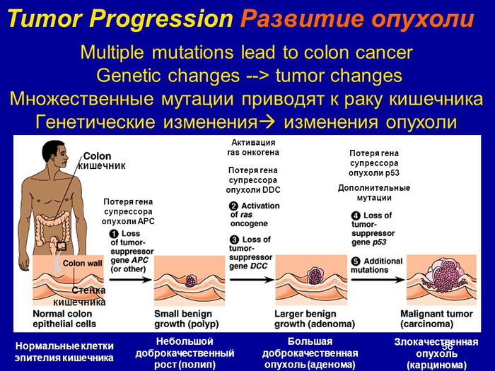 Kllirik.kir's answer to Cancer Vaccine - news, Cancer and oncology, Medications, Vaccine, Reply to post, A wave of posts, Longpost, Blokhin Cancer Center, Tumor, Video, Youtube, Video VK