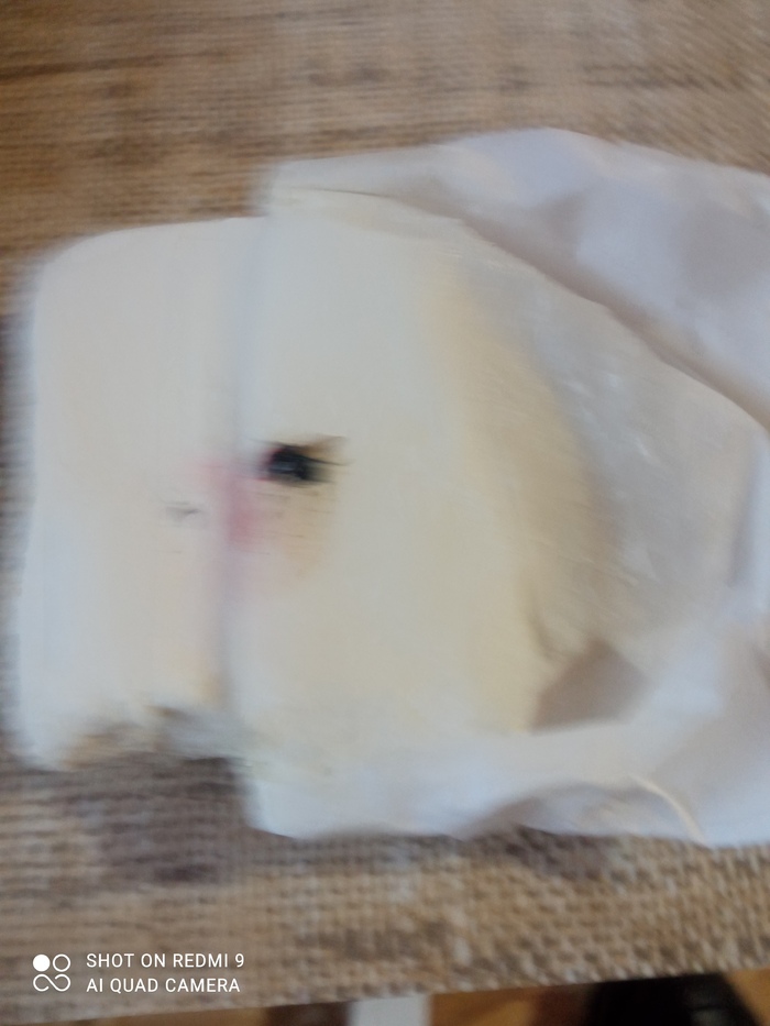   , . ,            .      - &#x1F92E;