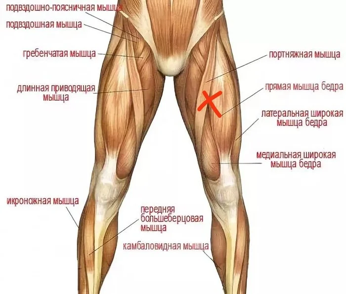 Colitis in the leg - Sport, Workout, Health, Exercises, Тренер, Sports Tips, Athletes, Muscle, Doctors, Doctors need help, Question, Ask Peekaboo, Experience, Personal experience