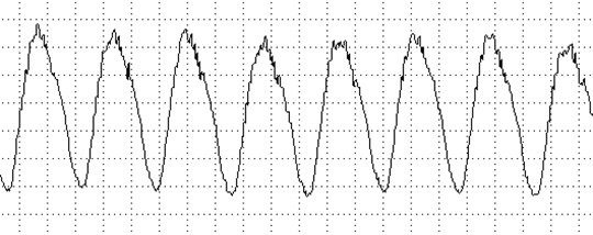 How can you determine this with an oscilloscope? - My, Car service, Auto repair, Spare parts, Auto, AvtoVAZ, Критика, Negative, Chinese cars, Tuning, Truck, Engine, Bmw, Opinion, Driver, Mercedes, Computer diagnostics, Longpost, Auto electrician, Want to know everything, Toyota, Mat