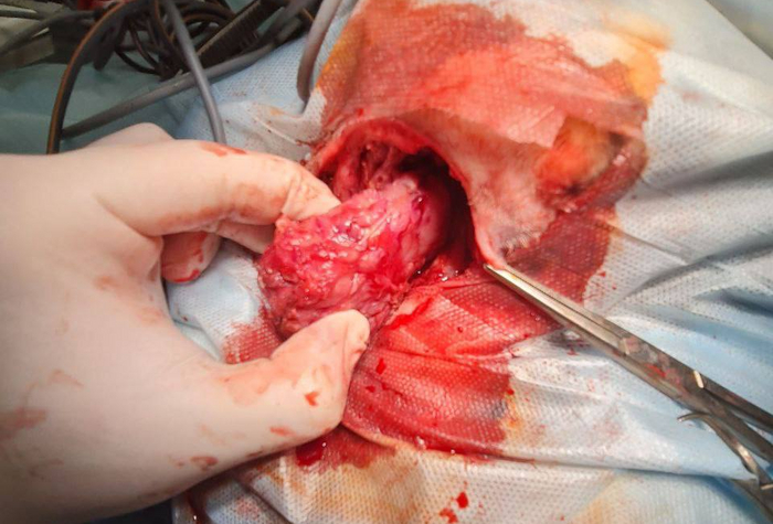 И вот так вот извлекаем.